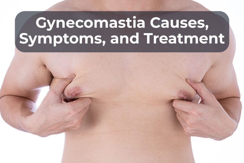 Gynecomastia causes and symptoms - Gynecomastia Center of Los Angeles