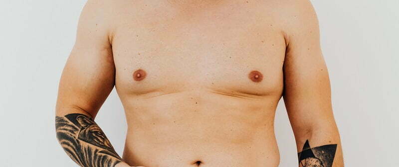 gynecomastia or male breast enlargement in & near Los Angeles