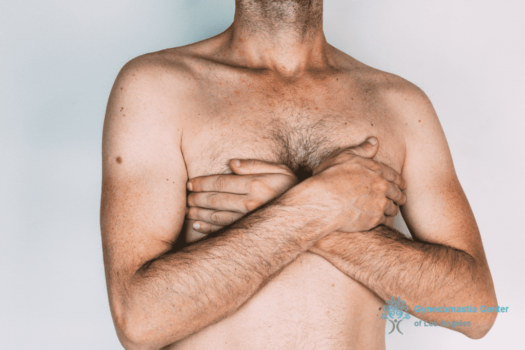 a man covering his chest with hands in & near Los Angeles - Gynecomastia Surgery Do’s and Don’ts