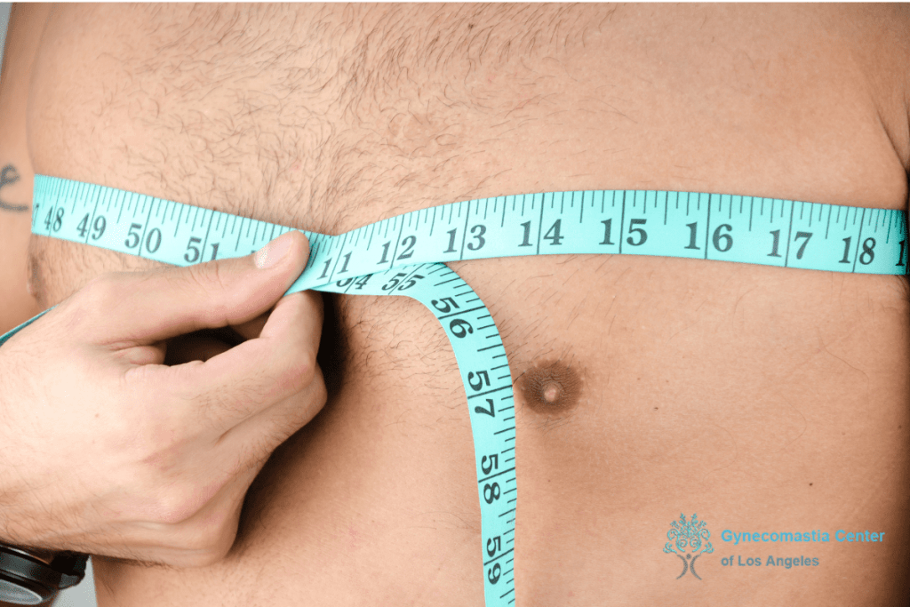 Gynecomastia Surgery Do's and Don'ts for Los Angeles Patient