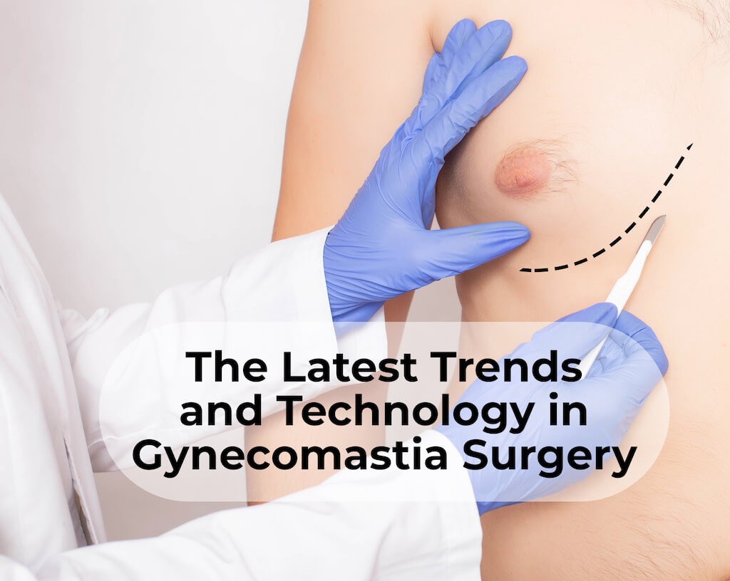 Latest trends in gynecomastia surgery technology - Gynecomastia Center of Los Angeles