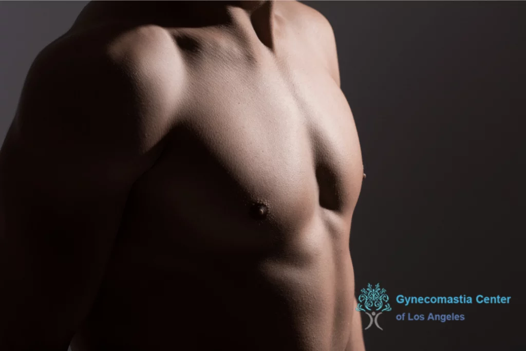 How to Shape the Chest After Gynecomastia Surgery