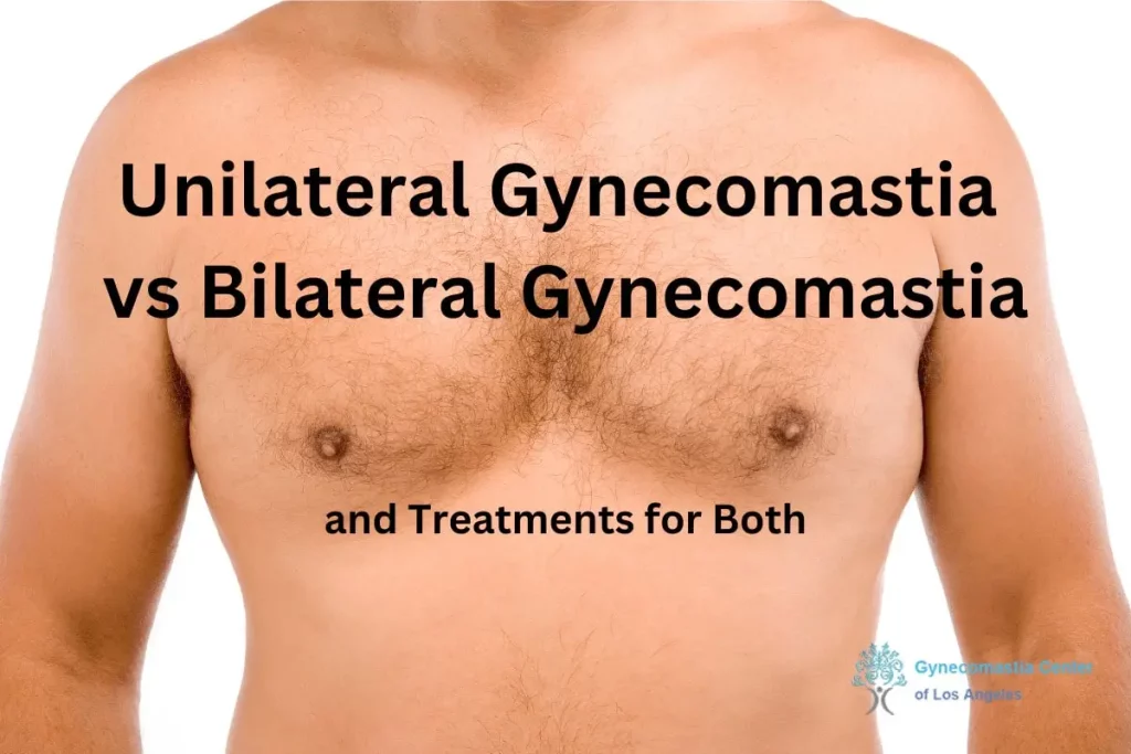 Unilateral Gynecomastia vs Bilateral Gynecomastia