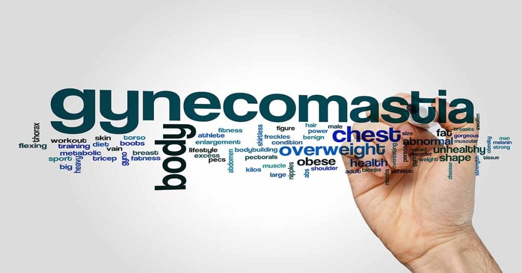 Gynecomastia Los Angeles