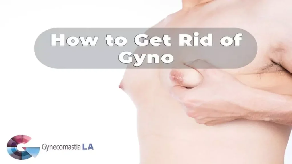 How to get rid of cyno LA, CA