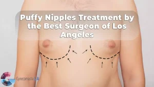 Puffy nipples treatment by the best surgeon of los angeles.