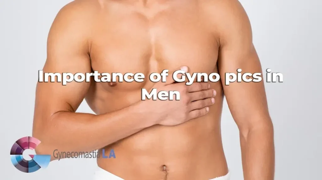 Importance of cynopics in men.