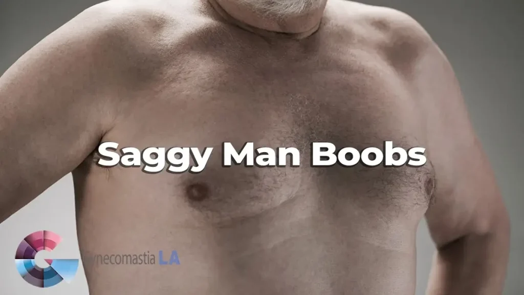Saggy man Boobs Los Angeles