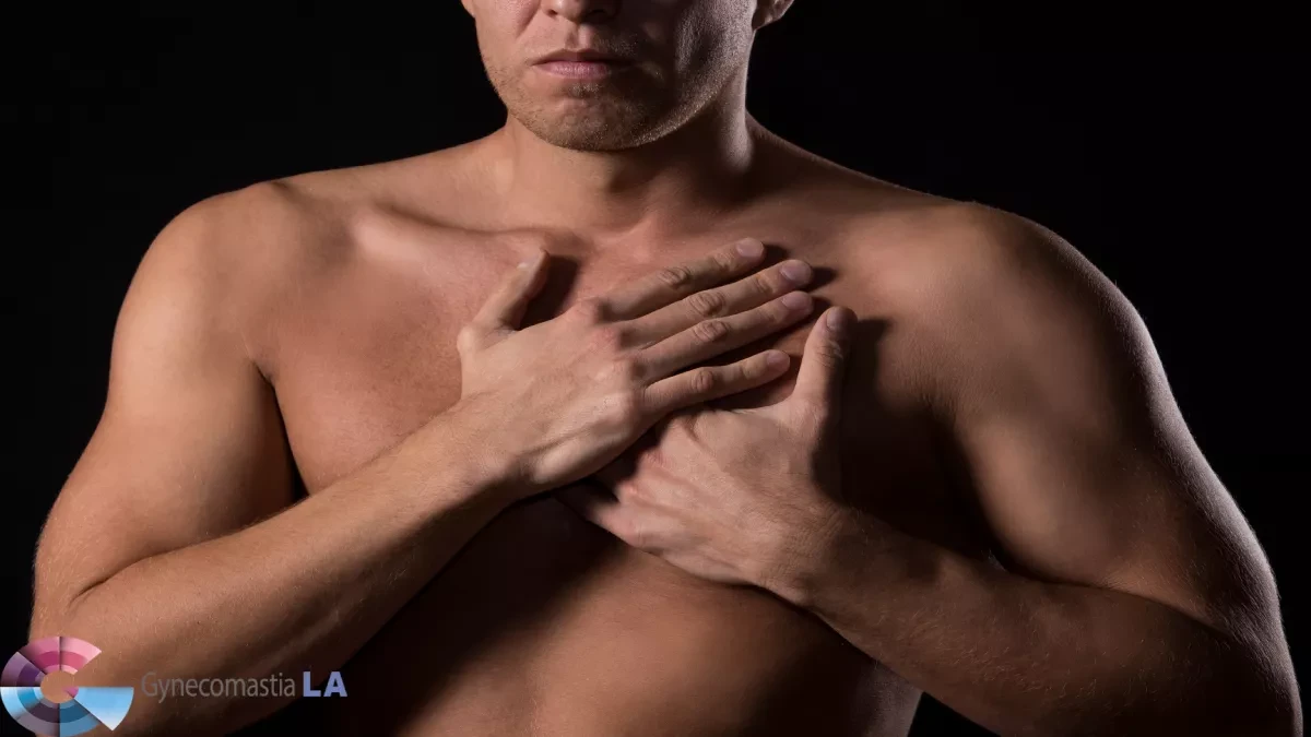 Gynecomastia Before and After Los Angeles