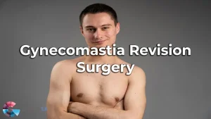 Gynecomastia Revision Surgery Los Angeles, CA