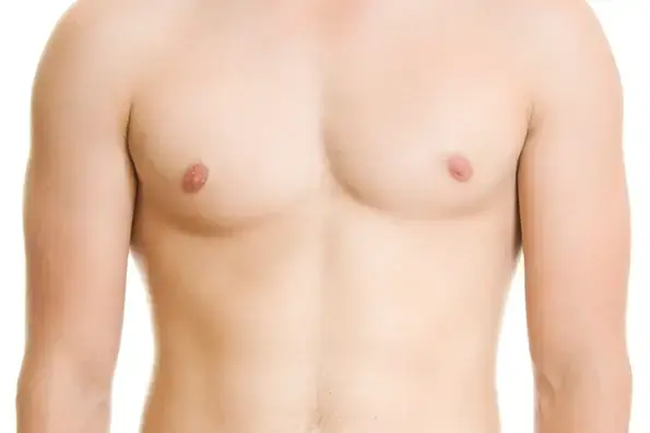 Adult Gynecomastia