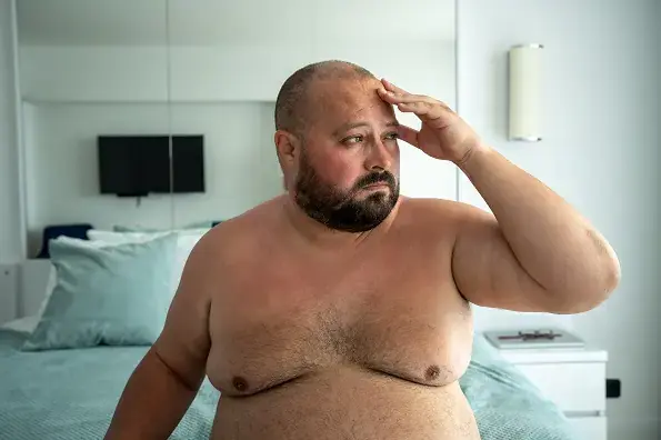 Gynecomastia in Overweight Men