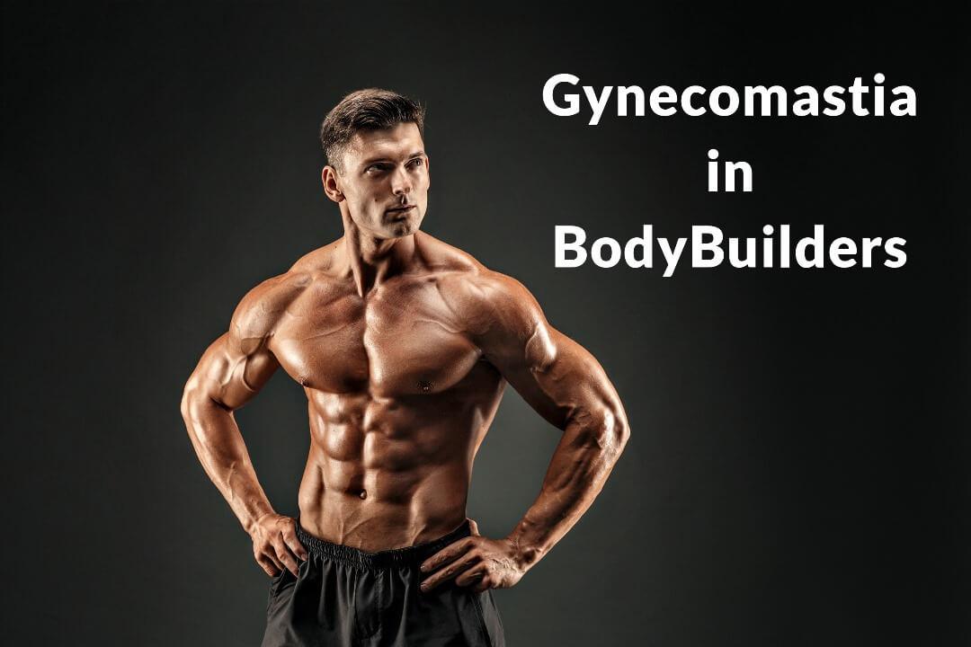 Gynecomastia in BodyBuilders Los Angeles, CA