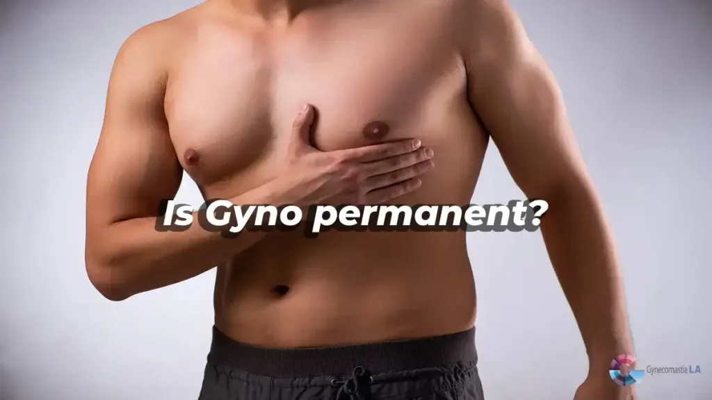 Is Gyno permanent? Get tios from Gynecomastia La center