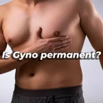 Is Gyno permanent? Get tios from Gynecomastia La center