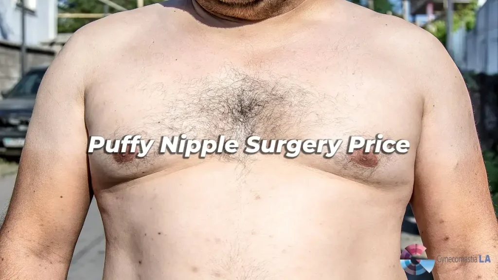 Puffy Nipple Surgery Price Los Angeles, CA