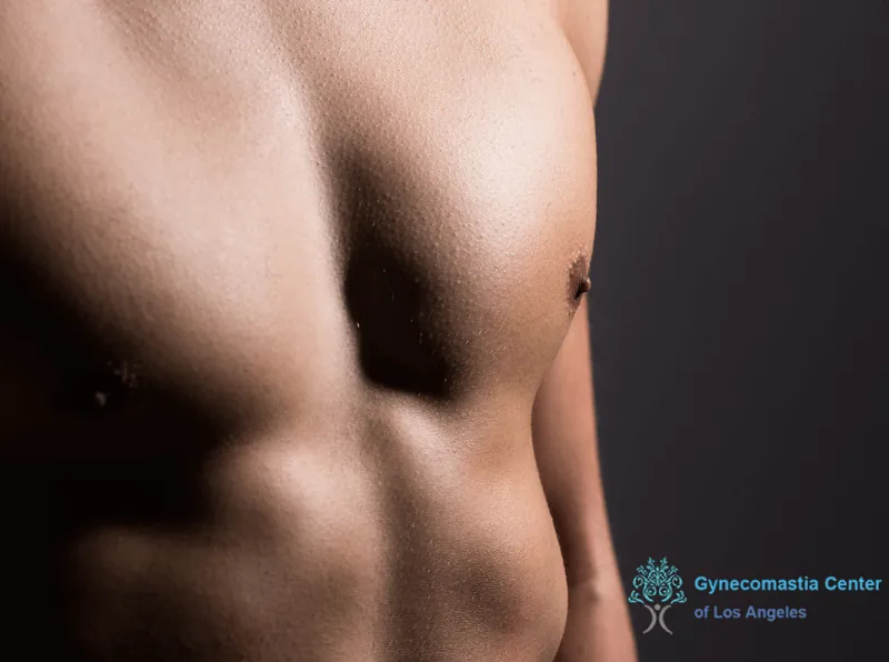 a bodybuilder prepared for gynecomastia surgery in & near Los Angeles