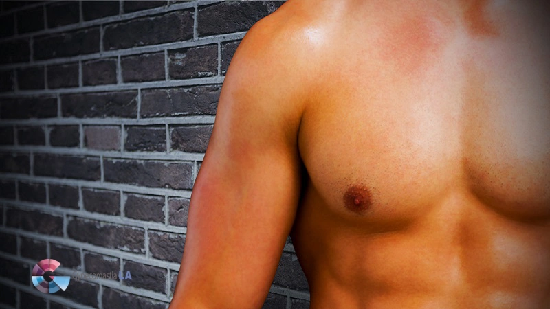Best Time for Male Breast Reduction Surgery in Los Angeles, CA