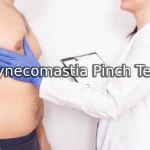 Gynecomastia Pinch Test- Gyno Center in Los Angeles