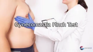 Gynecomastia Pinch Test- Gyno Center in Los Angeles