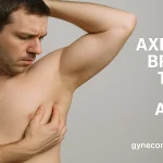 Axillary Breast Tissue vs Armpit Fat-Tips from Dr. Moein in LA