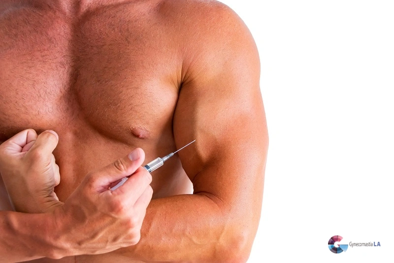 Why Does Gynecomastia Come Back