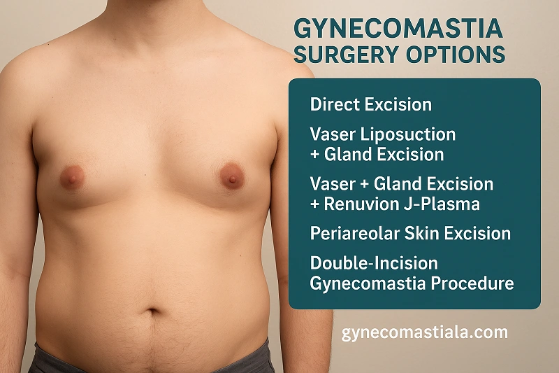 Gynecomastia Surgery Options by Grade