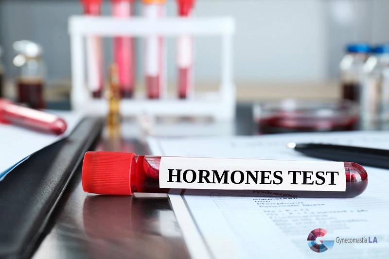 Role of Hormonal Testing in the Diagnosis of Gyno