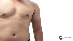 Ozempic Breasts in Men | Tips from Dr. Moein in LA
