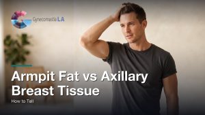 Armpit Fat vs Axillary Breast Tissue: How to Tell