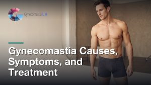 Gynecomastia Causes, Symptoms, and Treatment