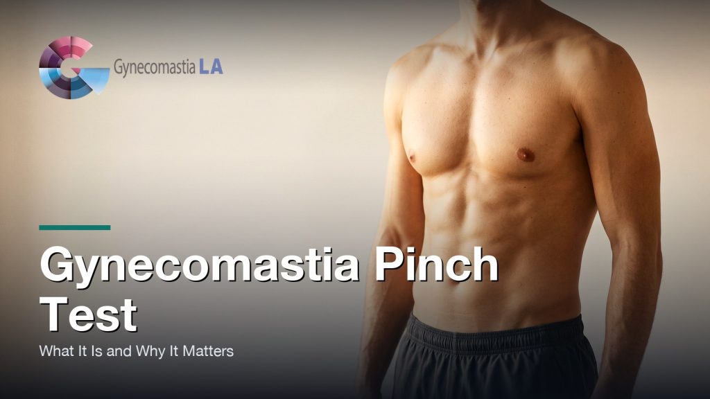 Gynecomastia Pinch Test: What It Is and Why It Matters, Gynecomastia Centers of Los Angeles