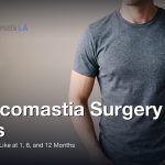 Gynecomastia Surgery Scars: What They Look Like at 1, 6, and 12 Months, Gynecomastia Centers of Los Angeles