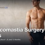 Gynecomastia Surgery Scars: What They Look Like at 1, 6, and 12 Months, Gynecomastia Centers of Los Angeles