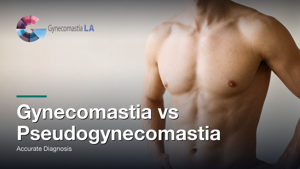 Gynecomastia vs Pseudogynecomastia: Accurate Diagnosis, Gynecomastia Centers of Los Angeles