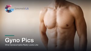 Gyno Pics: What Gynecomastia Really Looks Like