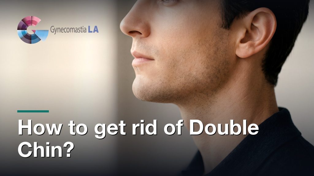 How to get rid of Double Chin?, Gynecomastia Centers of Los Angeles