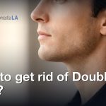 How to get rid of Double Chin?, Gynecomastia Centers of Los Angeles