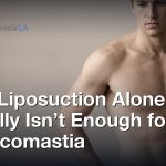 Why Liposuction Alone Usually Isn’t Enough for Gynecomastia, Gynecomastia Centers of Los Angeles