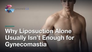 Why Liposuction Alone Usually Isn’t Enough for Gynecomastia, Gynecomastia Centers of Los Angeles