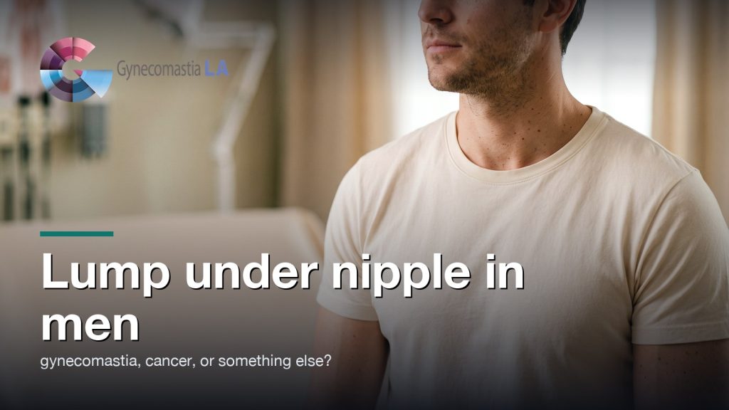 Lump under nipple in men: gynecomastia, cancer, or something else?, Gynecomastia Centers of Los Angeles