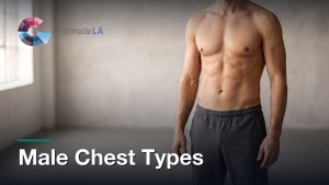 Male Chest Types