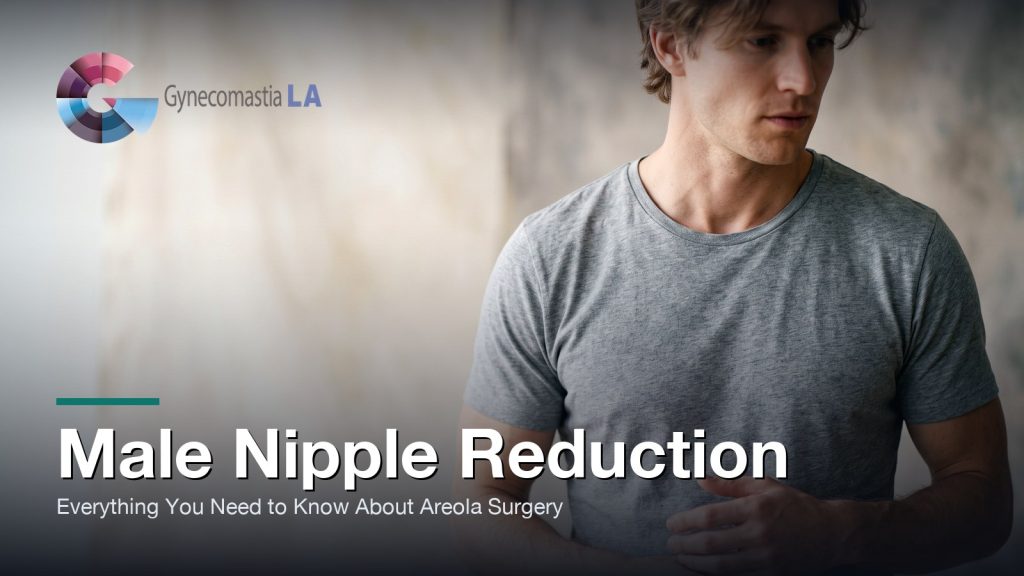 Reducción de Pezón Masculino: Todo lo que Necesitas Saber sobre la Cirugía de la Areola