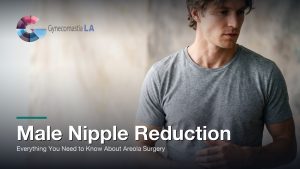 Male Nipple Reduction: Everything You Need to Know About Areola Surgery