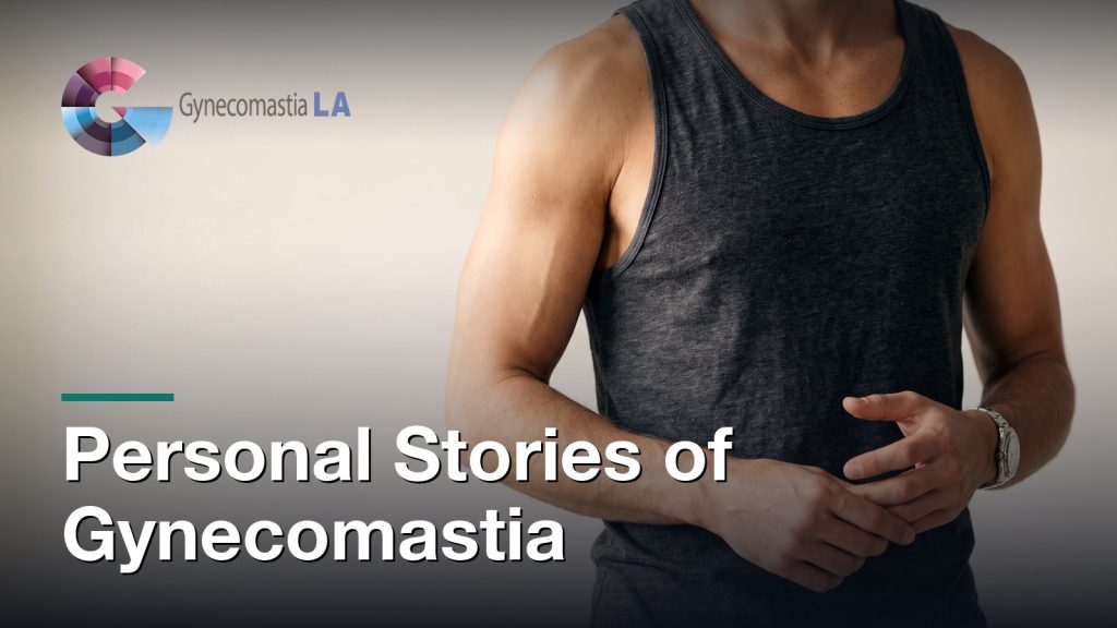 Personal Stories of Gynecomastia, Gynecomastia Centers of Los Angeles