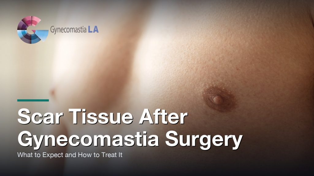 Scar Tissue After Gynecomastia Surgery: What to Expect and How to Treat It, Gynecomastia Centers of Los Angeles