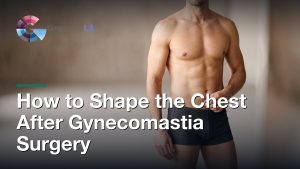 How to Shape the Chest After Gynecomastia Surgery