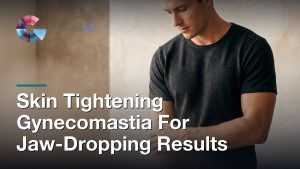 Skin Tightening Gynecomastia For Jaw-Dropping Results