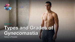 Types and Grades of Gynecomastia: Victory is Possible