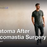 Hematoma After Gynecomastia Surgery: Signs and Treatment, Gynecomastia Centers of Los Angeles